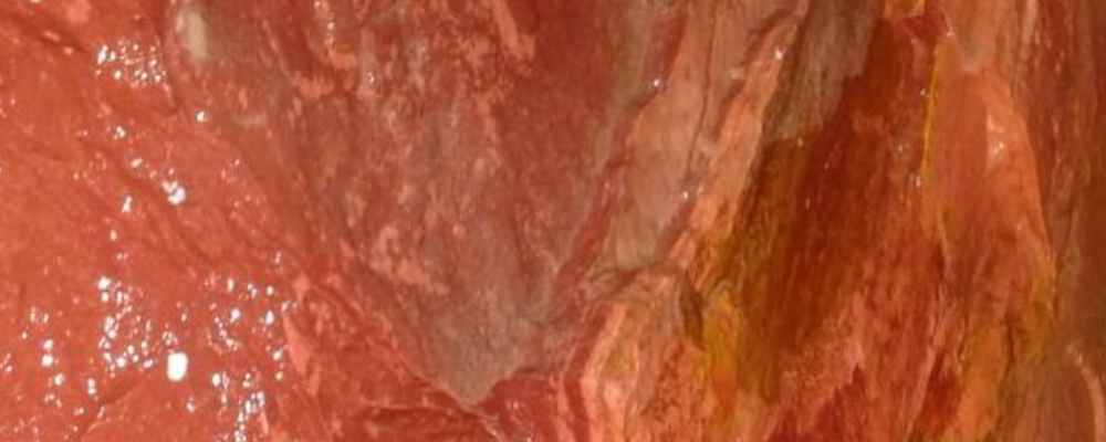 Catlinite